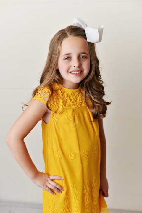 Lace Dress – Yellow